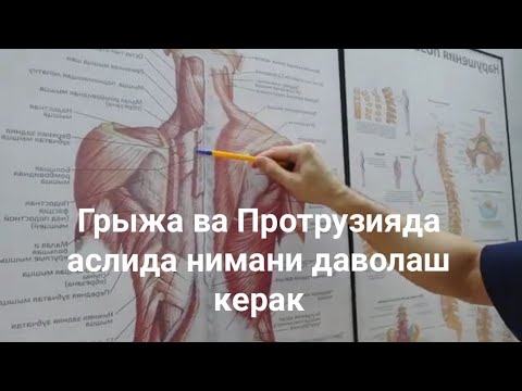 Видео: Грыжа ва Протрузияда аслида нимани даволаш керак +998993527333
