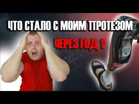Видео: ЧТО СТАЛО С МОИМ ПРОТЕЗОМ ЧЕРЕЗ ГОД? |4 ГОДА БЕЗ НОГИ🔥
