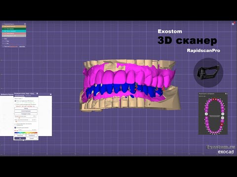 Видео: Как сопоставить waxup в тотальной работе?