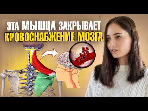 Видео: Плохое кровоснабжение мозга, боль в шее, инсульт, повышение давления — всё из-за ЭТОЙ мышцы