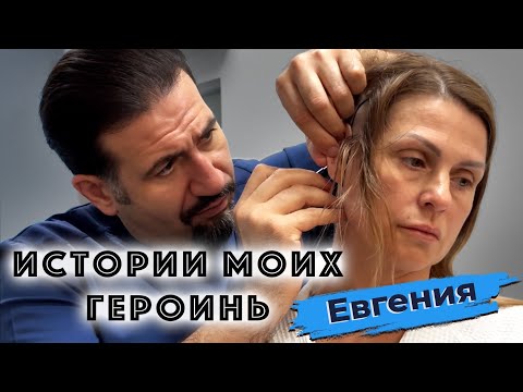 Видео: Истории моих героинь: Евгения,  омоложение лица