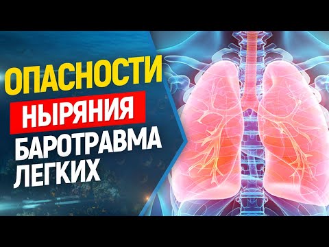 Видео: 👉Баротравма легких во фридайвинге и подводной охоте. Энциклопедия ныряльщика. Выпуск#5.
