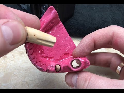 Видео: МОДЕЛЬ ГЕЛЛЕРА . Делаем первый раз. Зубной техник. Geller. Разборная модель . Видео курс