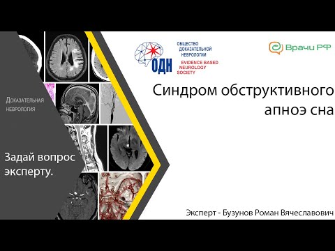 Видео: Синдром обструктивного апноэ сна