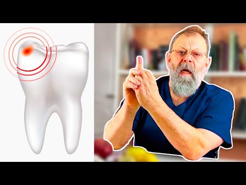 Видео: ЗУБНАЯ БОЛЬ БЫСТРО ИСЧЕЗНЕТ! Стоматологи этого вам точно не скажут!