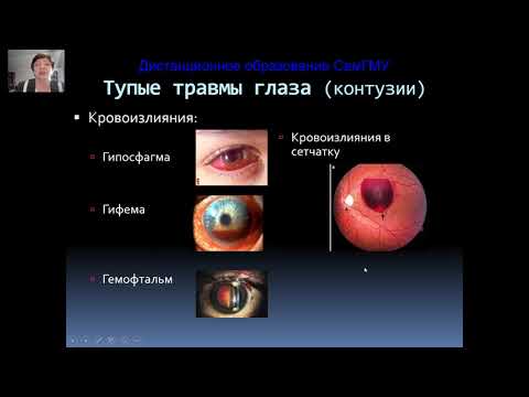 Видео: Повреждения глаз часть1