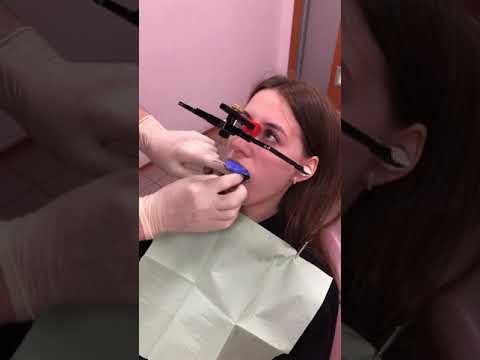 Видео: Применение лицевой дуги Reference AB