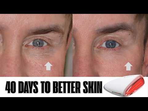 Видео: Лучший прибор для электропорации 2025 года? Laduora Lumeo: полный обзор, демонстрация и результат...