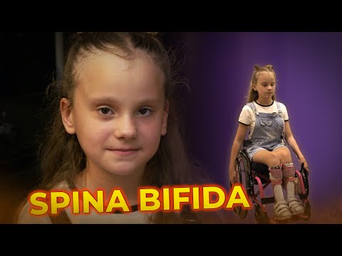 Видео: SPINA BIFIDA| История Анастасии Макиенко