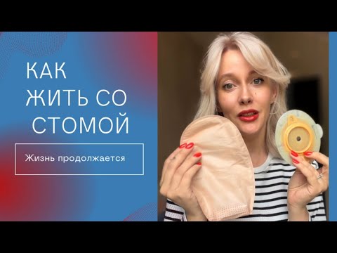 Видео: ЖИЗНЬ С КАЛОПРИЕМНИКОМ. Илеостома, отсутствие кишечника, инвалидность