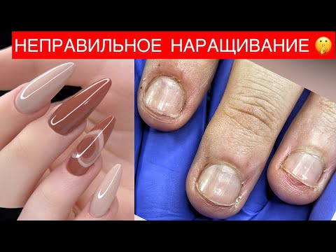 Видео: НОГТИ ГРЫЗУНА😬МАНИКЮР🔥НАРАЩИВАНИЕ НОГТЕЙ