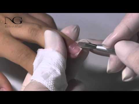Видео: Как обрезать кутикулу накожницами/How to cut the cuticle
