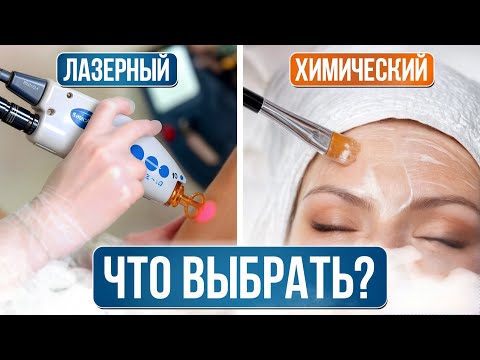 Видео: Пилинг, после которого РЕЗУЛЬТАТЫ ОСТАЮТСЯ НАДОЛГО! / Лазерный VS химический пилинг: что выбрать?