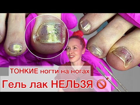 Видео: СЛОЖНЫЙ ПЕДИКЮР | ОБРАБОТКА НОГТЕЙ | КАК РАБОТАТЬ ФРЕЗОЙ #алена_лаврентьева #nails #ногти