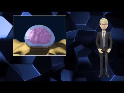 Видео: Протрузия диска позвоночника