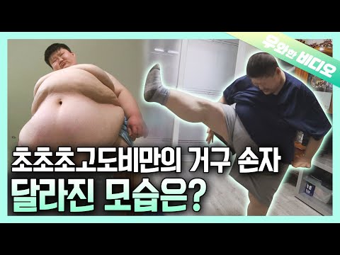 Видео: Внук с суперожирением, через год