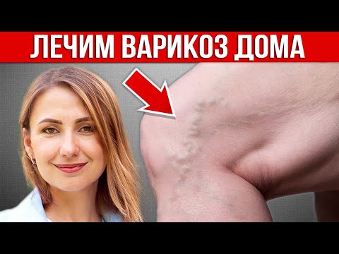Видео: Упражнения от ВАРИКОЗА | Тренировка при ВАРИКОЗЕ