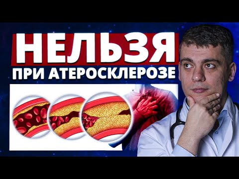Видео: Что НЕЛЬЗЯ делать при АТЕРОСКЛЕРОЗЕ? Почему сосуды СТАРЕЮТ раньше ВАС!?