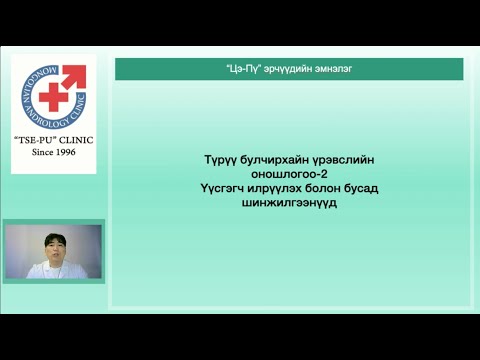 Видео: Түрүү булчирхайн үрэвслийн оношлогооны аргууд  2