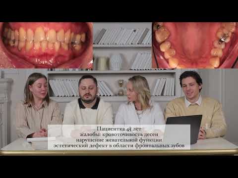 Видео: Разбор клинического случая от лекторов учебного центра Авиценна