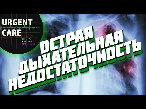 Видео: Лекция. Острая дыхательная недостаточность