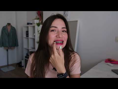 Видео: 9 месяцев с брекетами. Промежуточный результат. Скоро снимать?