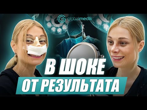 Видео: Блефаропластика и ринопластика в Турции | Опыт пациентки из США от консультации до результата