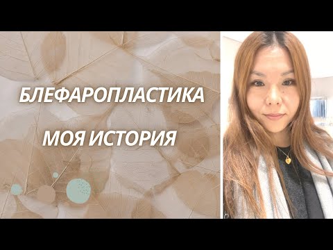 Видео: Vlog:Блефаропластика До/После👁️ Моя история | Astana🇰🇿Kazakhstan