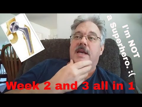 Видео: Замена тазобедренного сустава — обзор за 2 и 3 недели