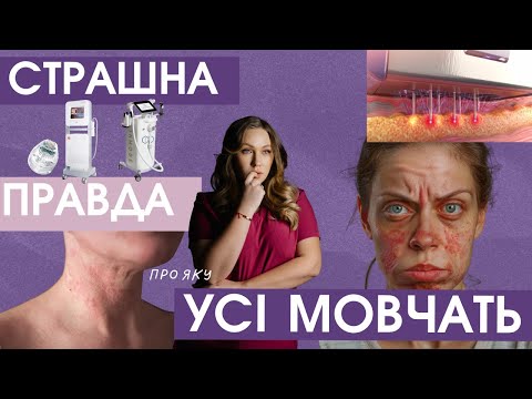 Видео: RF ліфтинг обличчя - розвіюю популярні міфи: зварює твою шкіру, залишає рубці і шрами.