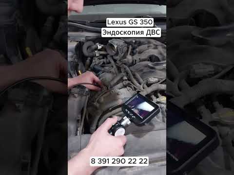 Видео: Эндоскоп в деле! Помогает поставить диагноз.