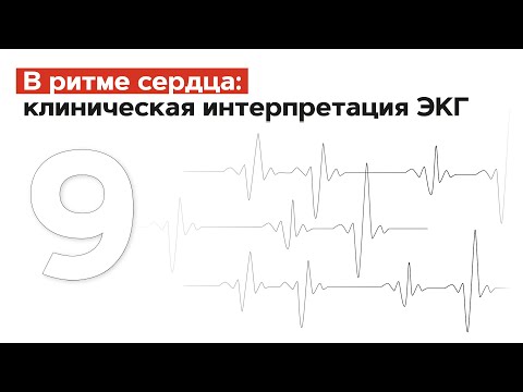 Видео: ЭКГ в возрастном аспекте . 12.07.22