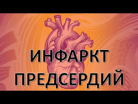 Видео: ЭКГ при инфарктах миокарда: ИНФАРКТ ПРЕДСЕРДИЙ. Клиническая значимость, особенности диагностики