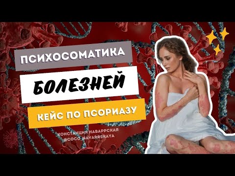 Видео: ПСИХОСОМАТИКА БОЛЕЗНЕЙ. ПСОРИАЗ