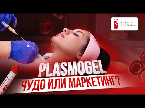 Видео: Как работает плазмогель? Узнай за 5 минут! #плазмотерапия #плазмогель