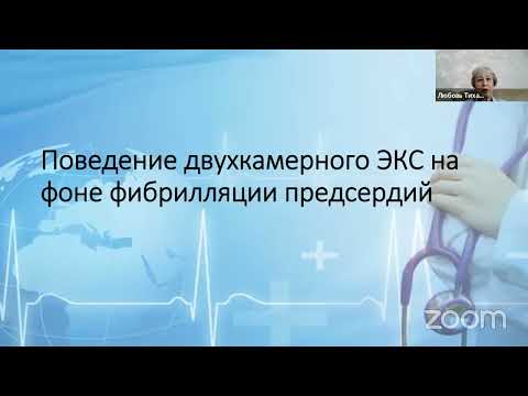 Видео: Основные трудности и ошибки при интерпретации ЭКГ у пациентов с ЭКС