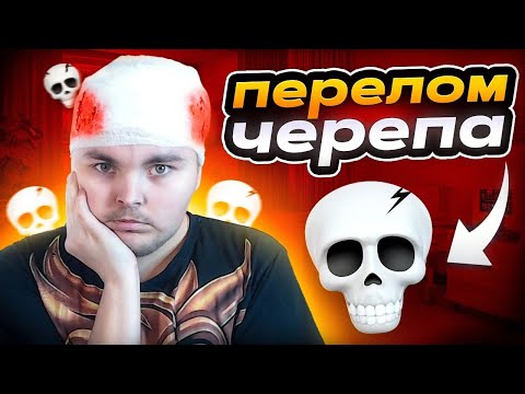 Видео: У МЕНЯ БЫЛ ПЕРЕЛОМ ЧЕРЕПА? История из Жизни!
