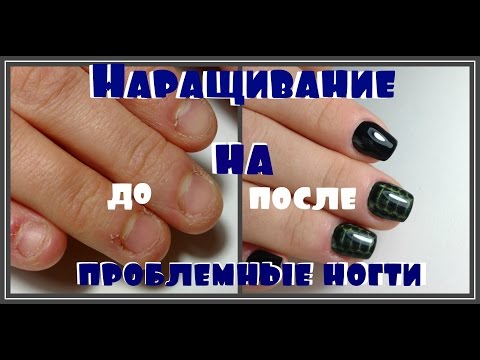 Видео: Наращивание на ПРОБЛЕМНЫХ Ногтях / Преображение Ногтей Грызунчика / Татьяна Бугрий