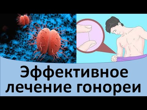 Видео: Эффективное лечение гонореи