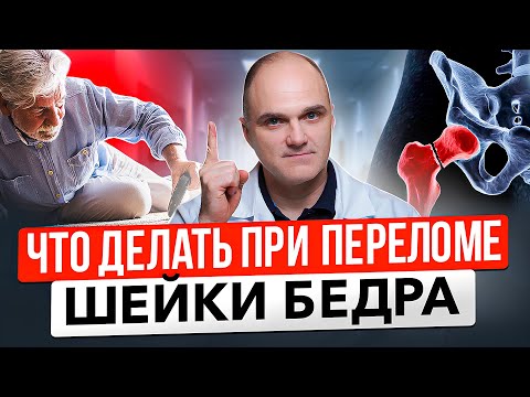 Видео: Перелом шейки бедра: симптомы, причины, лечение. Перелом шейки бедра у пожилых людей: что делать?
